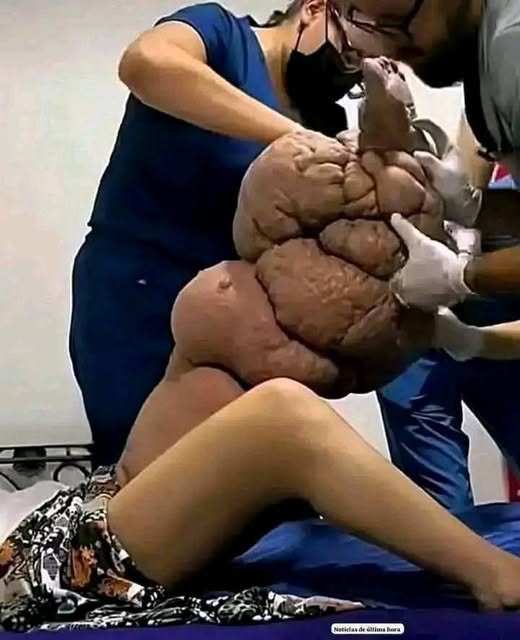 These are the causes of sleeping with a 1…See more