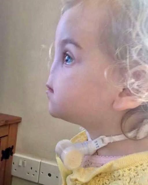 Born without a nose, here’s what Tessa Evans looks like at 12