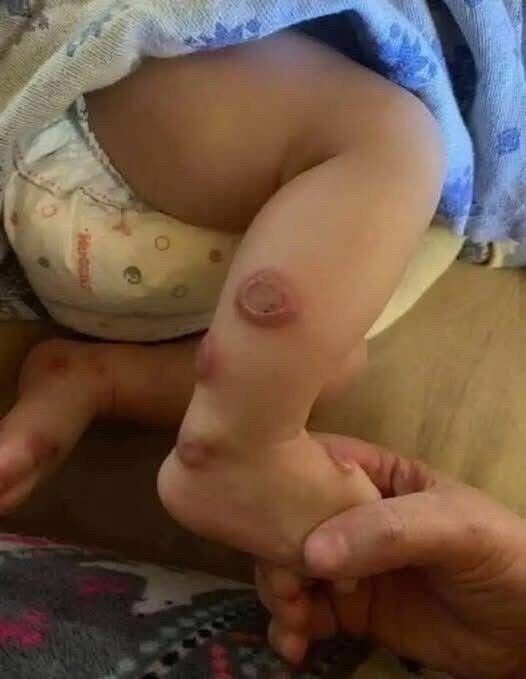 ALERT: These are the signs that it\’s cre…See more‼️ Uncategorized