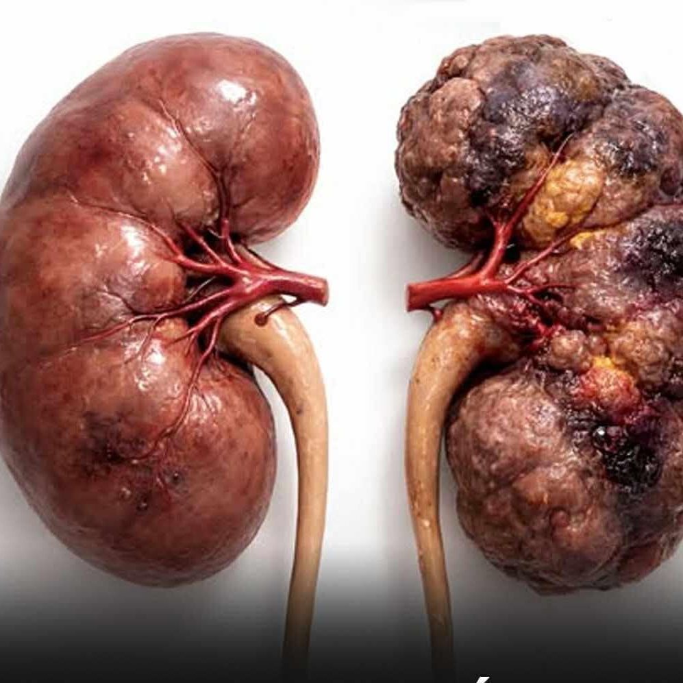 If you don’t drink 2 liters of water today, you’ll pay for it with your health tomorrow… See more