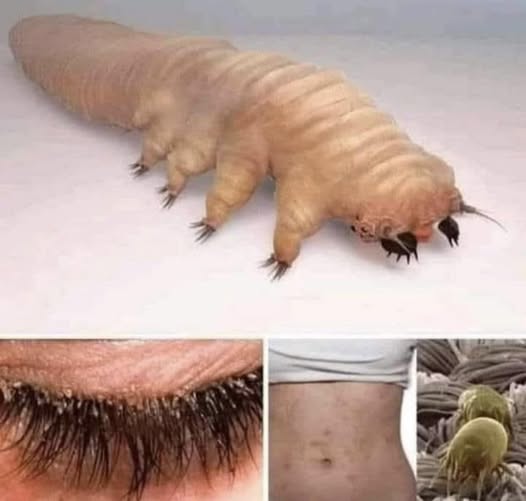 This small, creepy creature lives in your body and you won’t believe it, see more