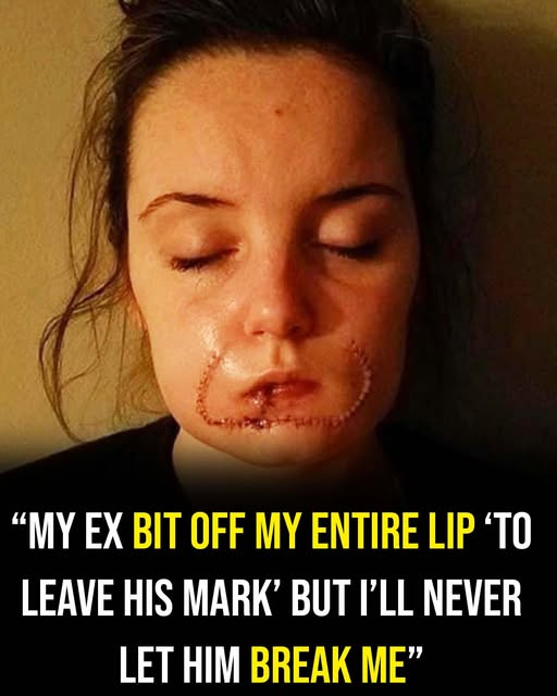 She thought it was love, but her ex left her scarred for life