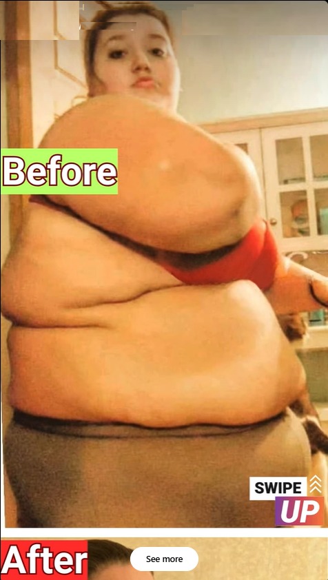 Lexi Reed’s Inspiring Transformation: From Battling a Rare Disease at 485 Pounds to Rocking a Swimsuit with Confidence