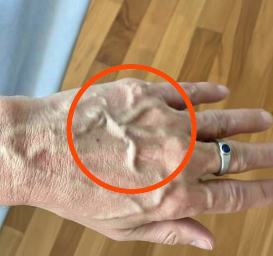 If you have visible veins it means you areโฆ