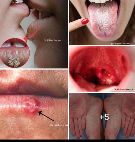 F. Don’t Underestimate It: Recognizing the Early Signs of Oral Can…