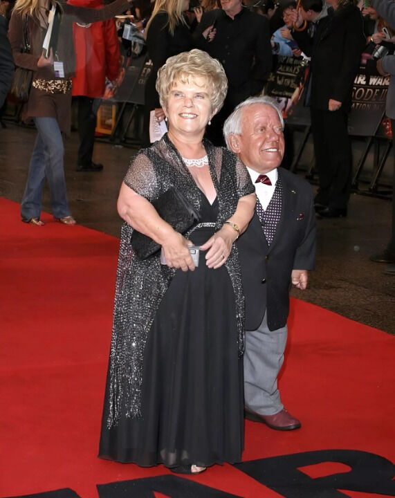 How Determination Can Redefine Limits: The Inspiring Story of Kenny Baker