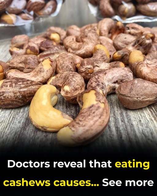 Doctors reveal that eating cashews causes