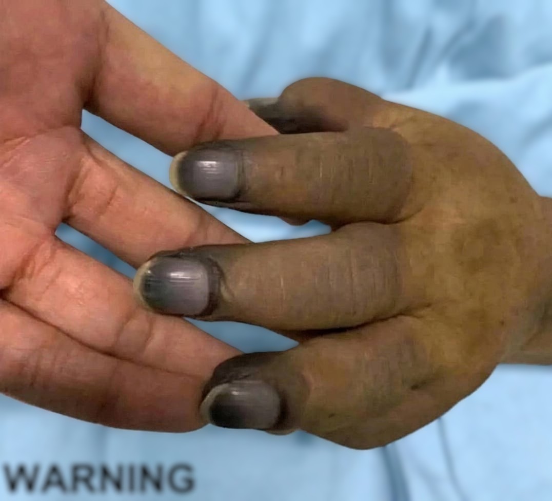 These are the consequences of painting your nails with c… See more