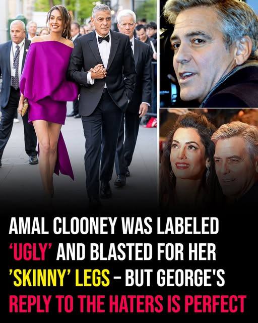 Amal Clooney was labeled ‘ugly’ & blasted for her skinny legs — but George’s response to the haters is perfect… Check the comments 👇🏻