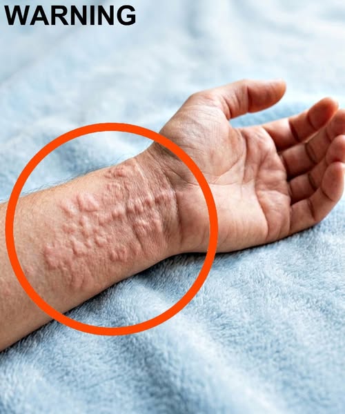 The Deadly Warning Signs Your Skin Is Sending You That You Should Never Ignore