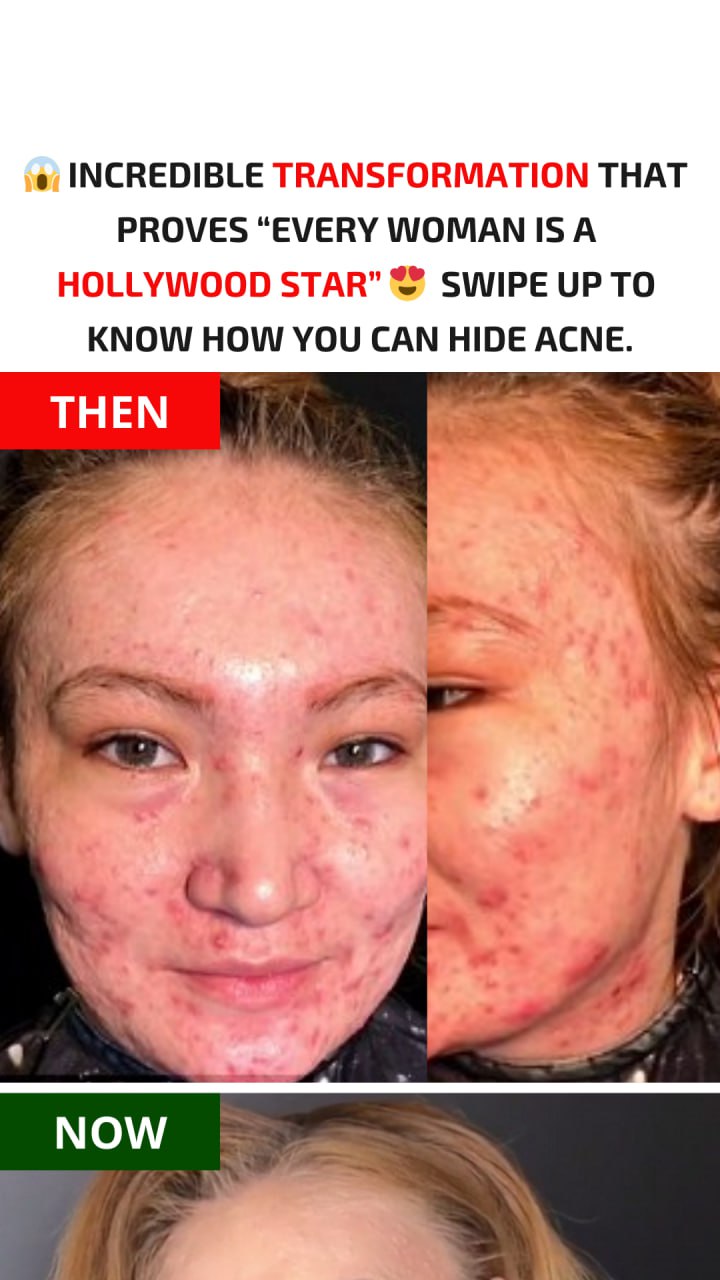 Amazing Makeovers That Show Every Woman Can Shine Like a Star