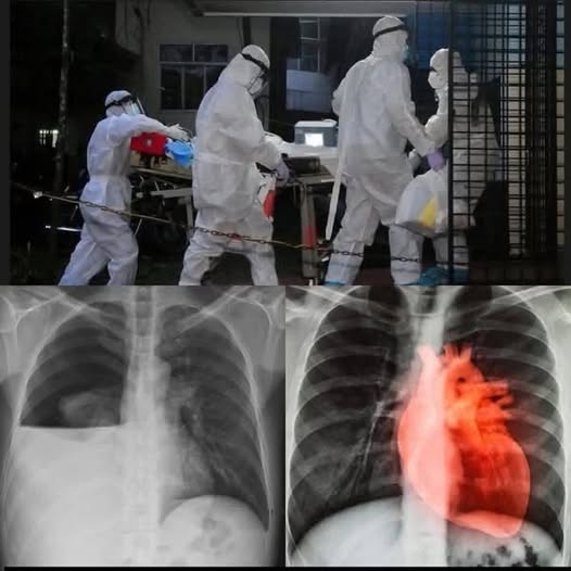 COVID-19 vaccinated individuals may be illโฆ.