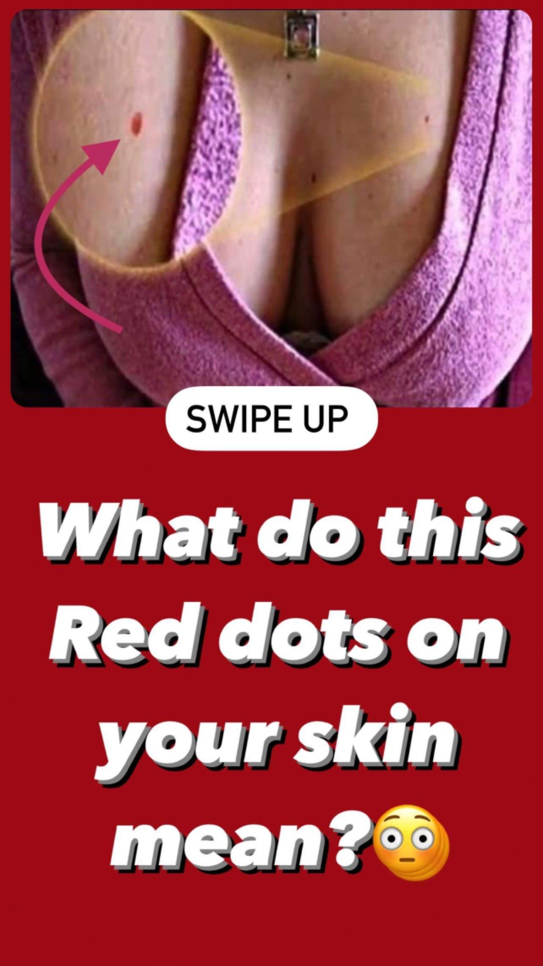 Red Dots on Your Skin? Hereโs What They Could Be Trying to Tell You