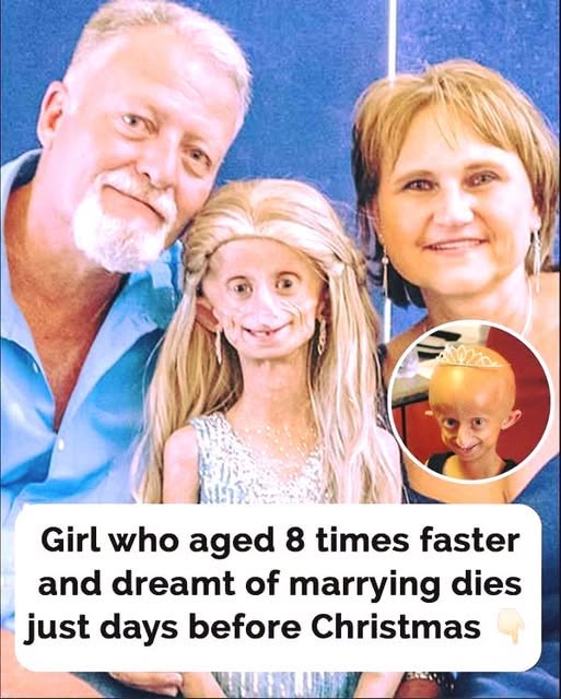 Beandri Booysen, South African Girl Living With Progeria, Has Passed Away